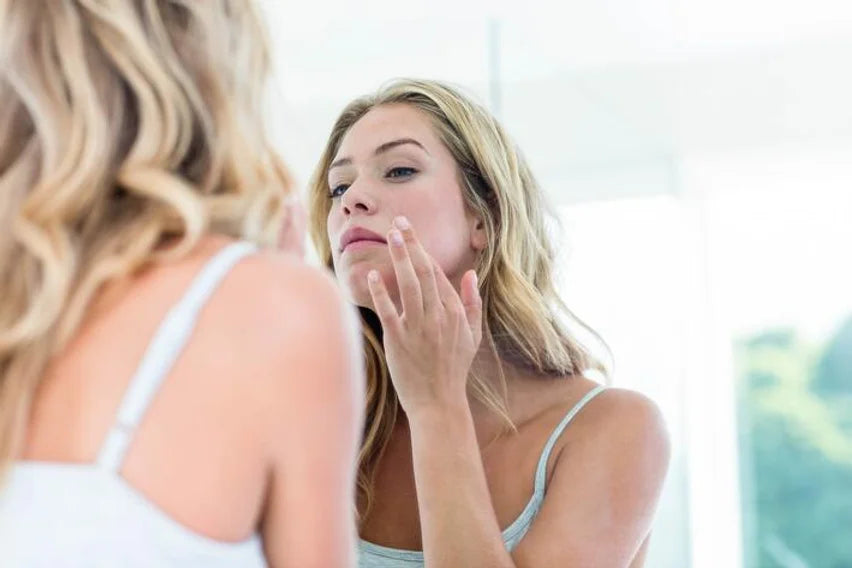 Pre and Post Care for Chemical Peels