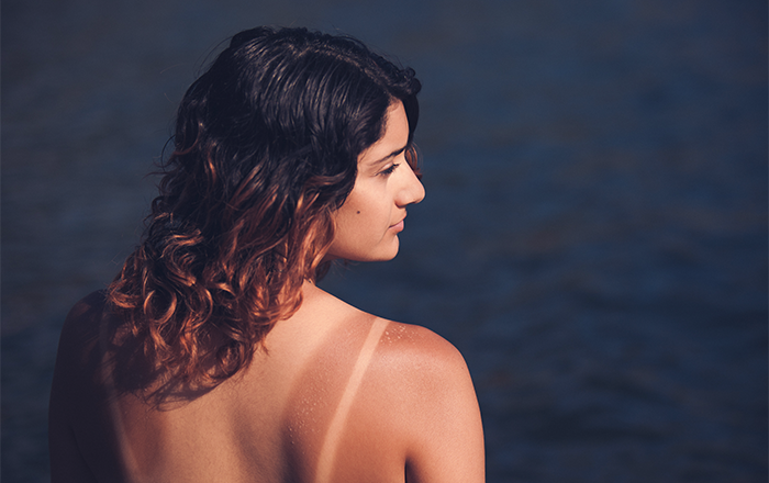 REVERSING SUN DAMAGE